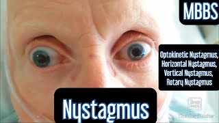 Nystagmus Optokinetic Horizontal Vertical Rotary mbbs medicine neetpg usmle [upl. by Amaerd]