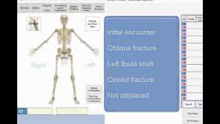 Cut ICD10 code lookup time from 35 minutes to 30 seconds [upl. by Hodgson]