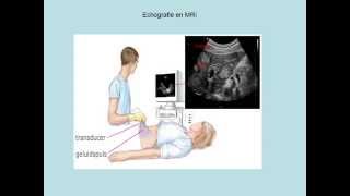 Echografie en MRI [upl. by Yard]