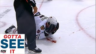 GOTTA SEE IT Blackhawks Murphy Bloodied By Pitlick Elbow To Face [upl. by Zeuqcaj587]