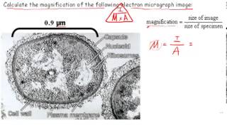 Calculating Magnification IB Biology [upl. by Vtarj]