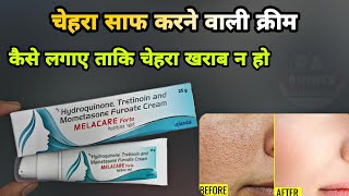 melacare forte cream  melacare forte cream uses in hindi  melacare cream  Prince Azeemuddin [upl. by Aoket]