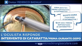 Intervento di Cataratta Cosa Succede Prima Durante e Dopo L’Oculista Risponde [upl. by Grier705]