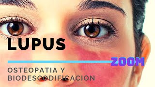 LUPUS ERITEMATOSO SISTEMICO una mirada osteopática y de Biodescodificación [upl. by Jemina]