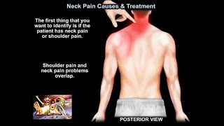 Neck Pain Causes and Treatment  Everything You Need To Know  Dr Nabil Ebraheim [upl. by Hamforrd]