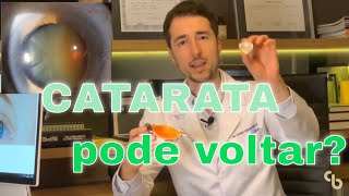 Catarata pode voltar O que é catarata O que é capsulotomia com YAG laser [upl. by Dulsea557]