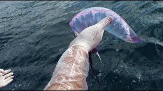 Man o War Killer Jellyfish at Mediterranean Spain Beaches Summer 2018 Travel Warning [upl. by Ahsienauq451]