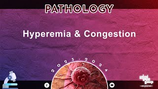 Revision of L13 Hyperemia and congestion Pathology [upl. by Etteiram746]