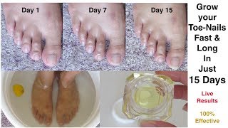 Grow your ToeNails fast and long in just 15 days  Faster Nail Growth  Mamtha Nair [upl. by Yemerej]