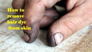 How to Remove Hair Dye from Skin स्कीन पर लगे हेयरडाय के निशान कैसे करें साफ Hair Dye Remover [upl. by Eralcyram]