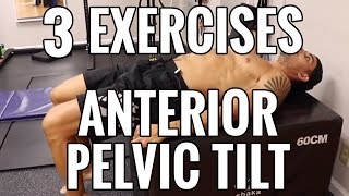 Correct anterior pelvic tilt  Anterior pelvic tilt exercises in hindi  Pelvic tilt kya hota hai [upl. by Inamik704]