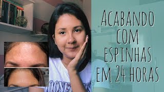 Como acabar com espinhas em 24 horas  SEM CLICKBAIT [upl. by Odraner530]