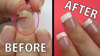 REPAIR A RIPPED NAIL FAST [upl. by Mirella]