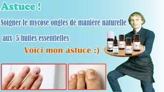 Lhuile essentielle ultime pour des soins complets et durables contre la mycose des ongles [upl. by Shepperd]