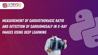 Measurement of Cardiothoracic Ratio and Detection of Cardiomegaly in XRay Images Using Deep Learning [upl. by Erl]