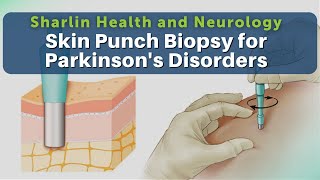 Get to Know About Skin Punch Biopsy for Alpha Synuclein Protein at Sharlin Health and Neurology [upl. by Nikki440]