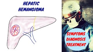 Hepatic Hemangioma  Liver Hemangioma [upl. by Letsirk974]