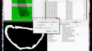 Cortical bone 1 periosteal and endosteal parameters [upl. by Akerdnuhs]