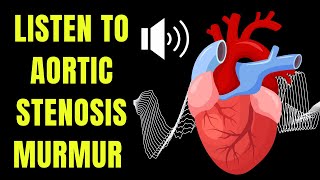 Doctor explains AORTIC STENOSIS including real heart SOUNDS of the murmur [upl. by Cate]