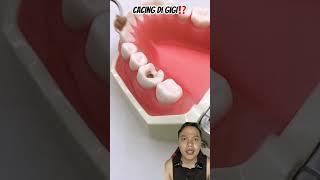 CACING DI GIGI⁉️ dentist teethshield diy healthyteeth satisfying handmade art music anime [upl. by Phi193]