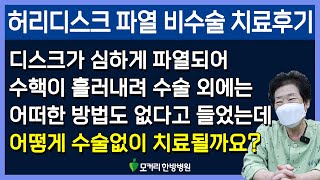 허리디스크파열 비수술치료후기11 파열이 심할수록 흡수가 잘되는데 왜수술을 서두릅니까 [upl. by Schuyler407]