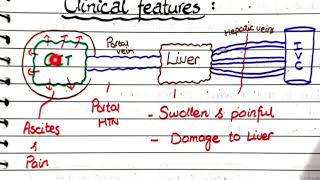 Budd Chiari Syndrome  Pathology [upl. by Schiff]