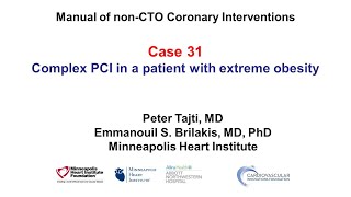 Case 31 PCI Manual  PCI and extreme obesity [upl. by Inva]