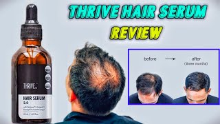 Thrive Hair serum Review After 3 months  Best Serum for hairfall and Hair loss [upl. by Kirenoj782]