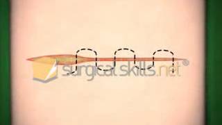 Subcuticular suture animation [upl. by Art832]