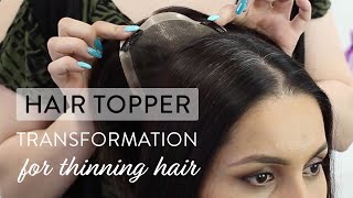 Hair Topper Transformation for Thinning Hair [upl. by Zined]