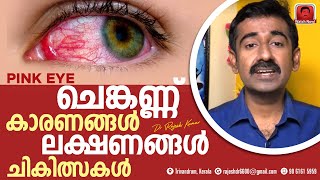 Conjunctivitis Pinkeye Causes Symptoms and Treatments [upl. by Bartie900]