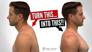 Fix Neck Hump FAST With These Home Exercises [upl. by Tatum486]