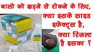 Mintop Yuva Solution 5 Minoxidil  DrReddys Mintop  Minoxidil Work🔥🔥 [upl. by Anitnatsnoc]