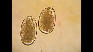 Hookworms in dogs  Ancylostoma caninum Flotation method [upl. by Zoila]