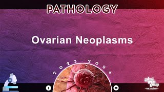 L5 Tut 2  Ovarian Neoplasms  Pathology [upl. by Caasi335]