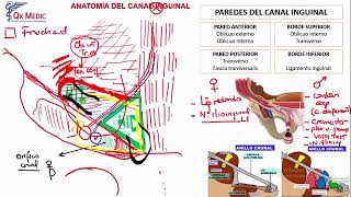 Hernia Inguinal y Crural [upl. by Enitsuga]