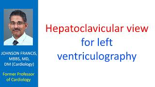 Hepatoclavicular view for left ventriculography [upl. by Lierbag]