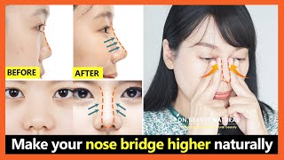 5 Best steps How to lift your nose bridge higher get perfect nose without surgery [upl. by Abran]