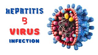 Chronic Hepatitis B Virus Infection [upl. by Balthazar136]