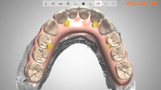 Fast 3shape gingiva [upl. by Tavie416]