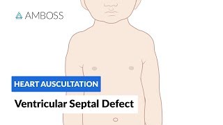 Ventricular Septal Defect VSD  Heart Auscultation  Episode 11 [upl. by Jenks752]