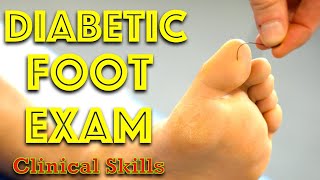 Diabetic Foot Examination  Clinical Skills  Dr Gill [upl. by Redla]