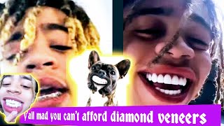 King Harris new big teeth 100000 for veneers ti and tiny clap back leave my son 😔 [upl. by Maggie]