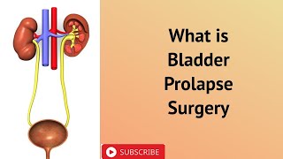 What is Bladder Prolapse Surgery [upl. by Aretina]