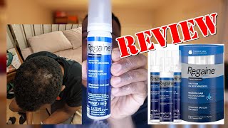 Regaine REVIEW Should you buy Regaine Foam Treatment [upl. by Mahan710]