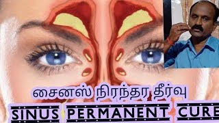 அரை மணி நேரத்தில் அரிப்பு நீங்க  home remedy for Itching in tamil skin problemnatural remedie [upl. by Raknahs]