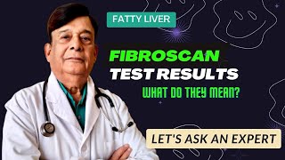 Liver FibroScan Test Results  Fatty Liver  Fibroscan of Liver Normal Range  Fatty Liver Treatment [upl. by Anbul]