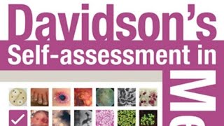 🌡️part 1 Endocrinology davidson self assessment [upl. by Lesli916]