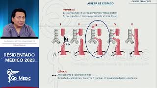 Cirugía pediátrica  1 Atresia de esófago [upl. by Stout]