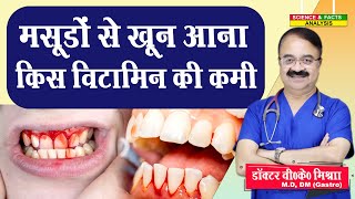 मसूड़ों से खून आना किस विटामिन की कमी  BLEEDING GUMS COULD BE A SIGN OF VIT C DEFICIENCY [upl. by Yelnikcm]